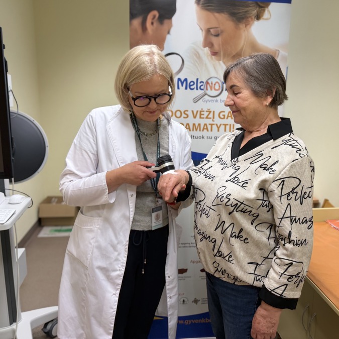 KUL medikai nemokamoje patikroje nustatė įtariamą melanomos atvejį: žmonės vis sąmoningiau rūpinasi oda